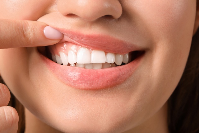 How long do cut gums take to heal