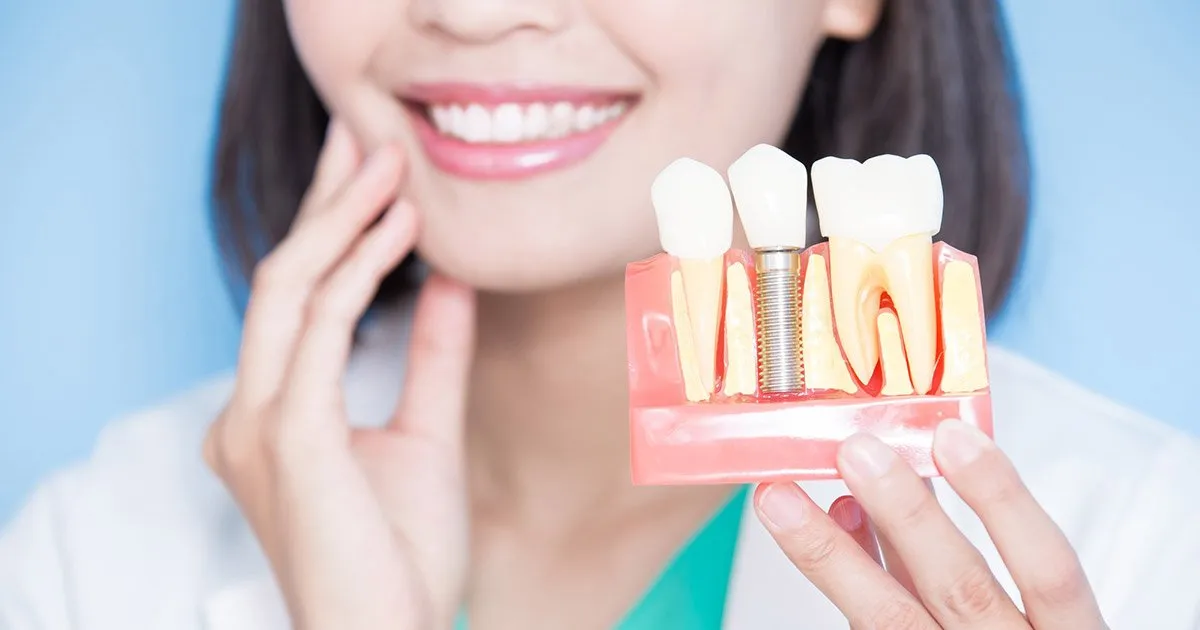 Signs you need dental implants