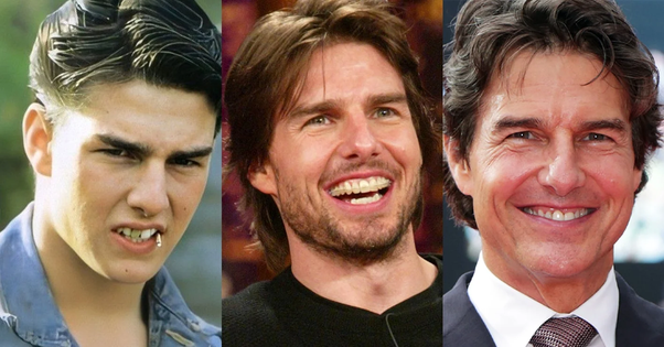 Tom Cruise teeth before 