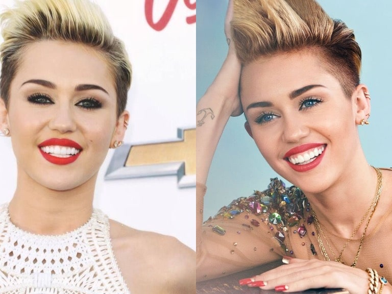 miley cyrus teeth before and after